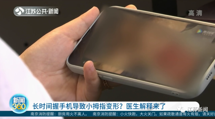 你还这么拿手机？医生紧急提醒！