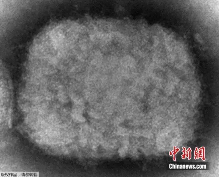 猴痘病毒已发生人际传播，如何保护自己→