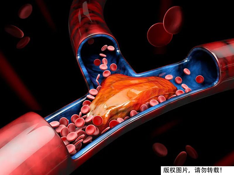 藏在身体里的"不定时炸弹"！血管好不好，摸脚背就能知道？今天学习到了