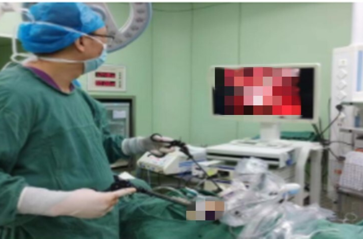 永兴县人民医院又成功完成一例肾错构瘤行腹腔镜下肾部分切除术