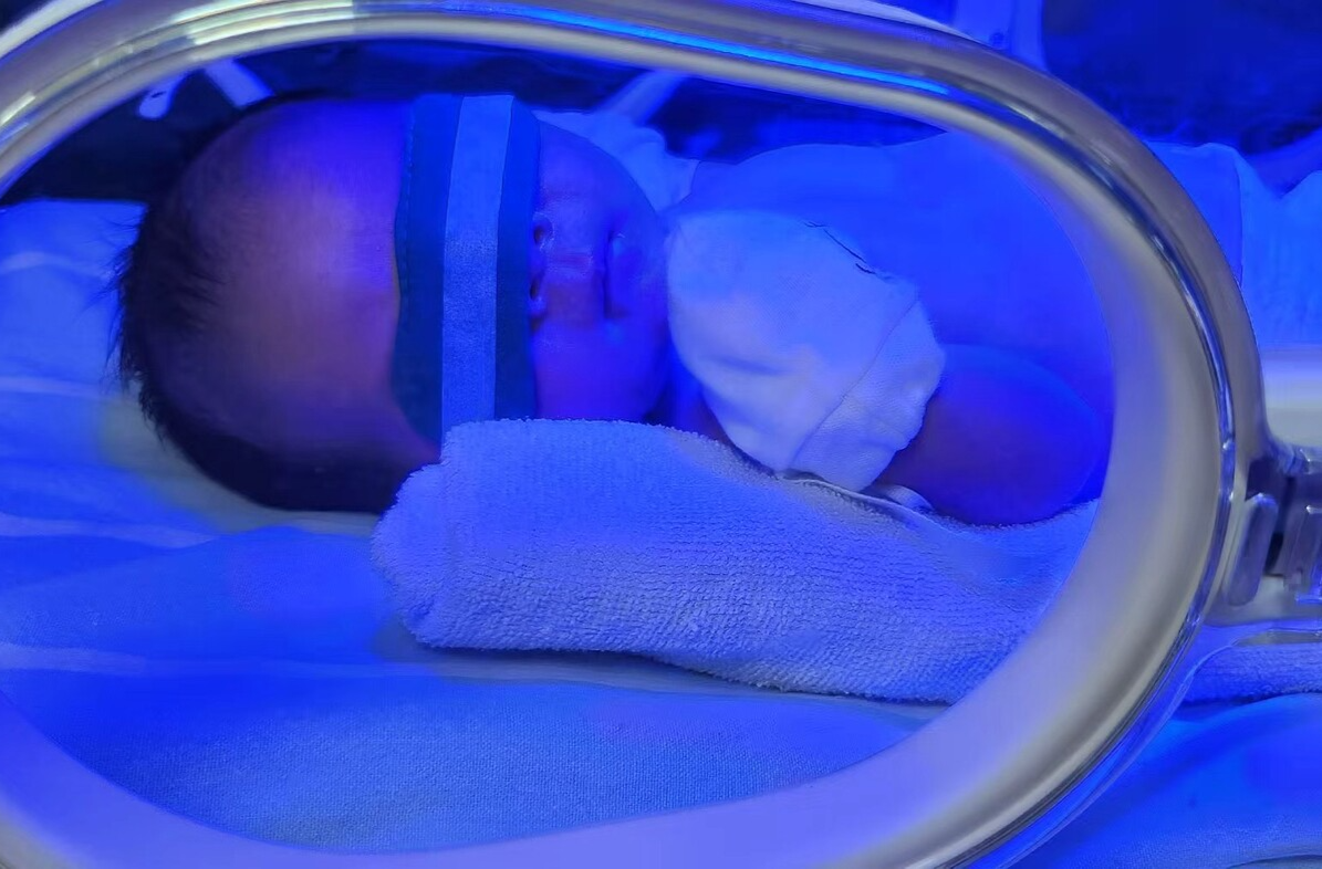 健康科普|什么是新生儿黄疸?什么是蓝光治疗?