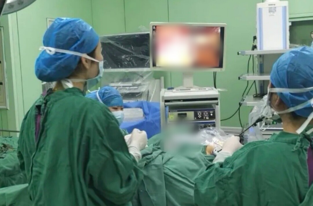 永兴县人民医院:爱跳舞女孩的巨大卵巢囊肿，单孔腹腔镜“隐形”疤痕助她圆梦