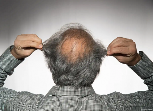 2026高口碑防脱洗发水排行榜！专业测评熬夜脱发效果好的防脱洗发水