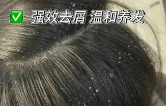 洗发水哪个好？去屑止痒控油蓬松，自用测评榜单