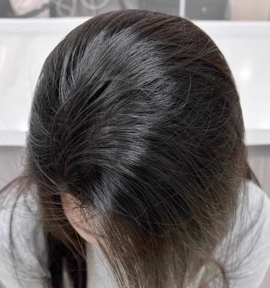 2026年实测揭秘：哪个牌子洗发水去屑控油效果真正好？