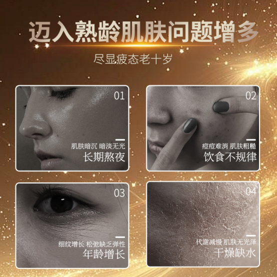 2026抗皱护肤品怎么选？大牌排名解析 儒曼套装实测封神，大牌种草