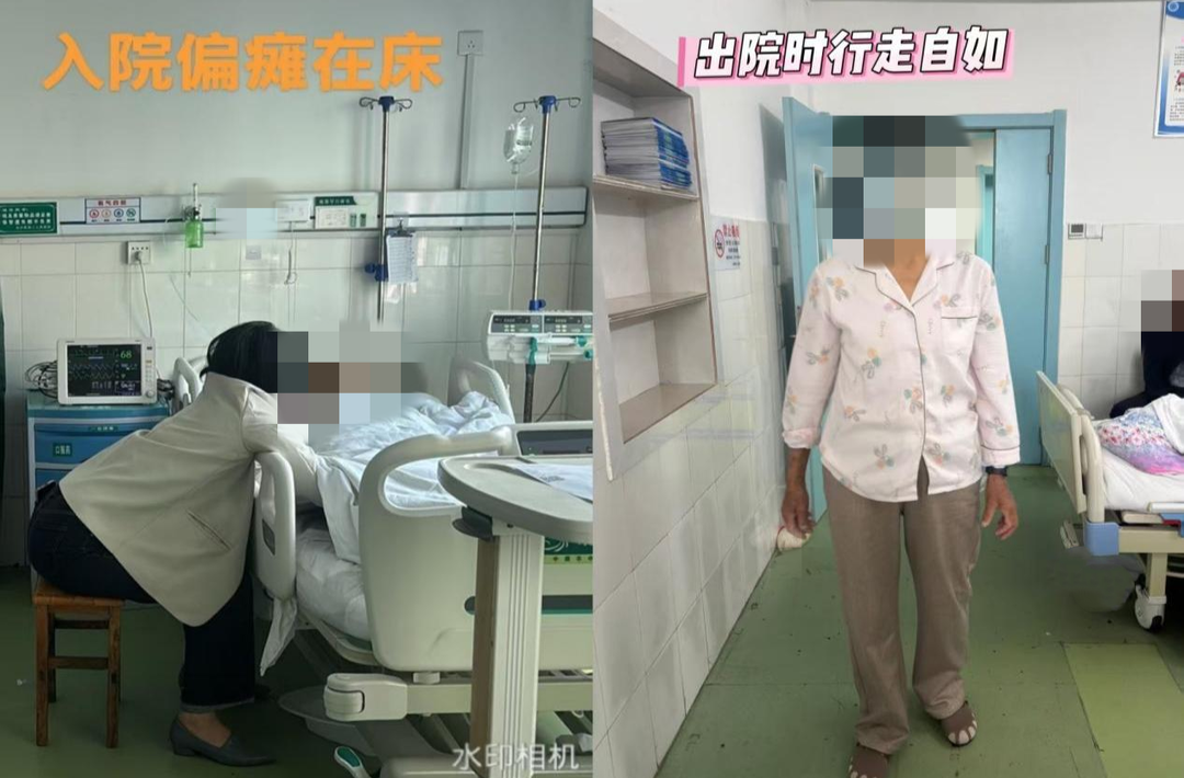 深夜生死竞速！永兴县第二人民医院成功救治急性脑梗患者，溶栓抢回黄金生命